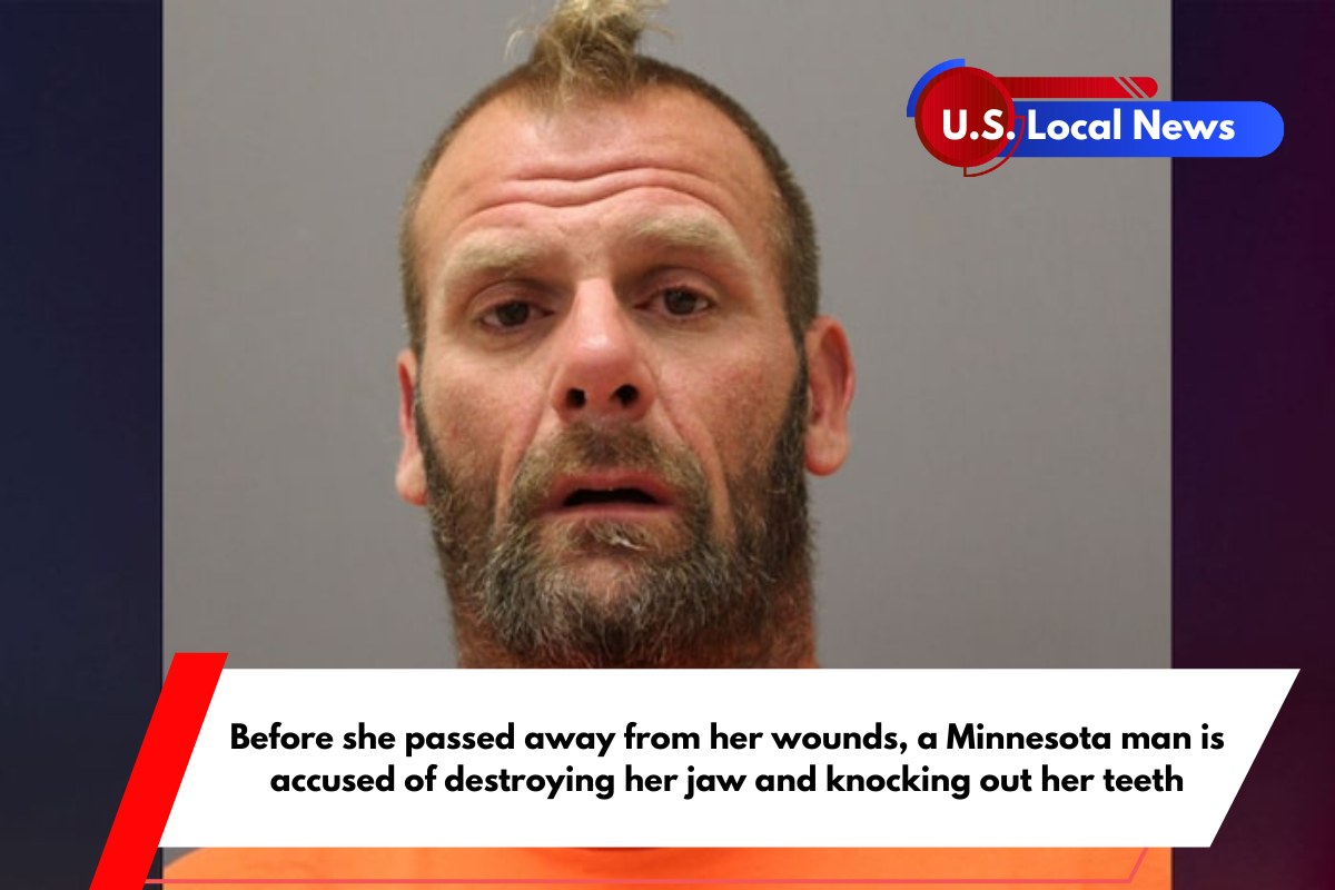 Before she passed away from her wounds, a Minnesota man is accused of destroying her jaw and knocking out her teeth