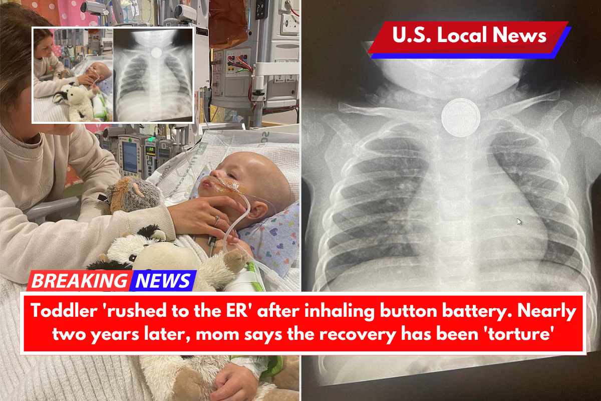 Toddler 'rushed to the ER' after inhaling button battery. Nearly two years later, mom says the recovery has been 'torture'